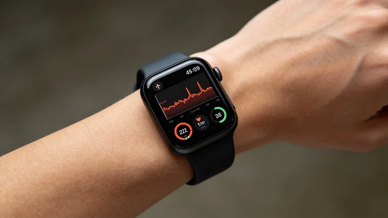 智能手表Apple Watch Series 11一年使用感受：我后悔了吗